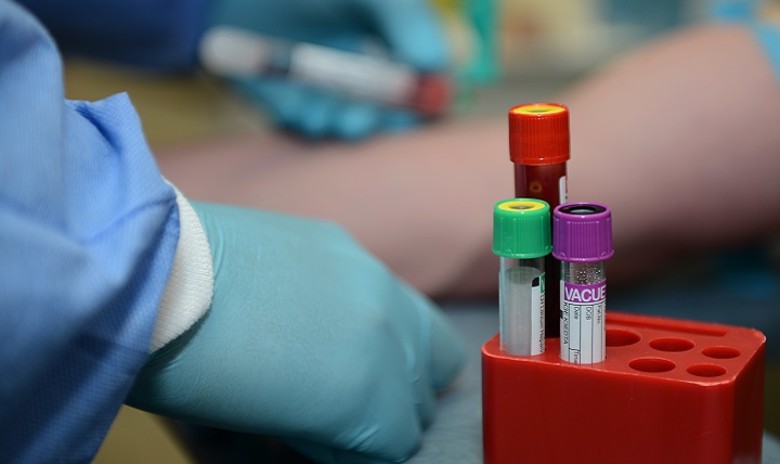 Cytogenetic Blood Testing