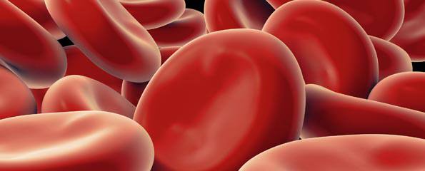 Haemophilia A