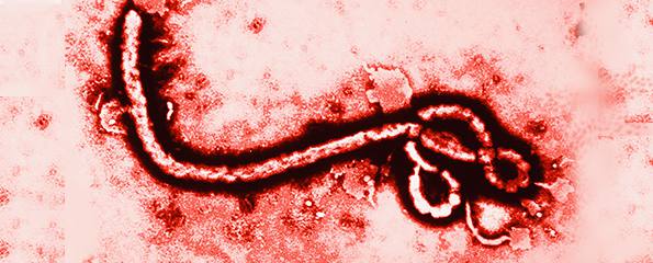 Ebola: Dr Joe Kosterich