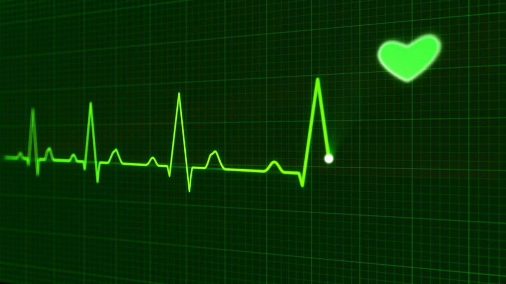 Echocardiogram Explained