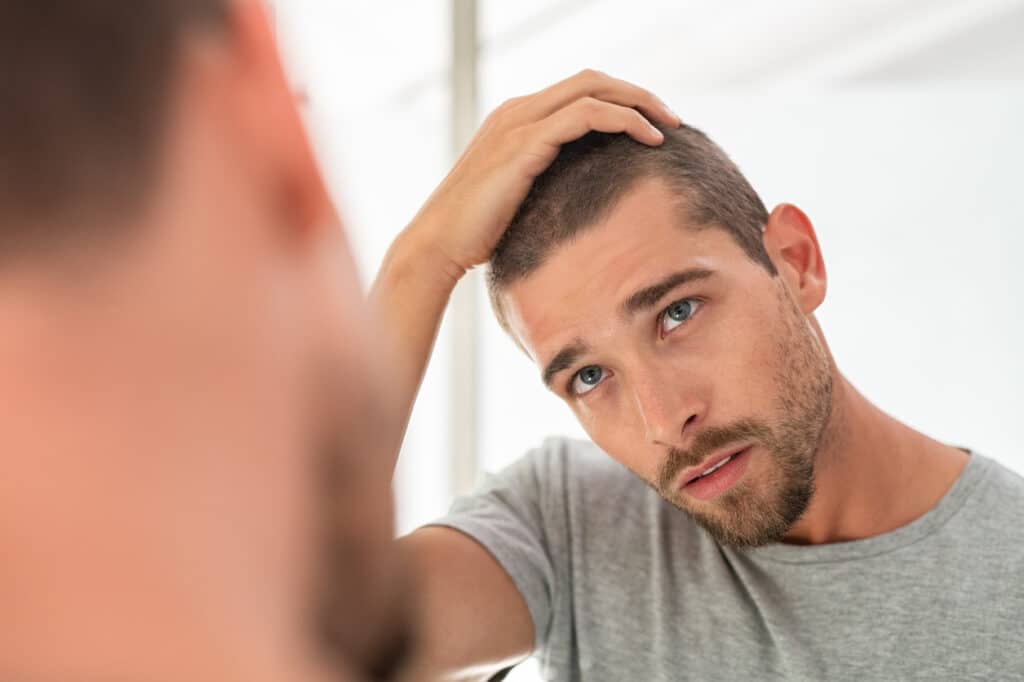Navigating the Ups and Downs of Men’s Hair Loss
