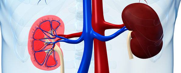 Nephrolithiasis (kidney stones; renal calculi; urinary stones)