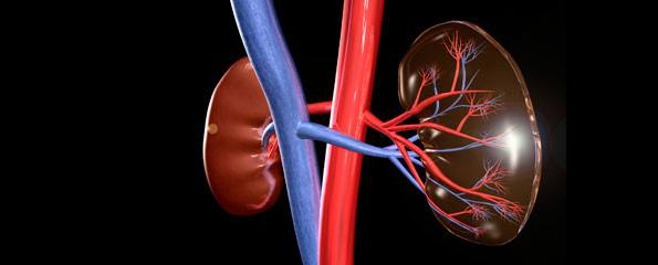 Lupus nephritis