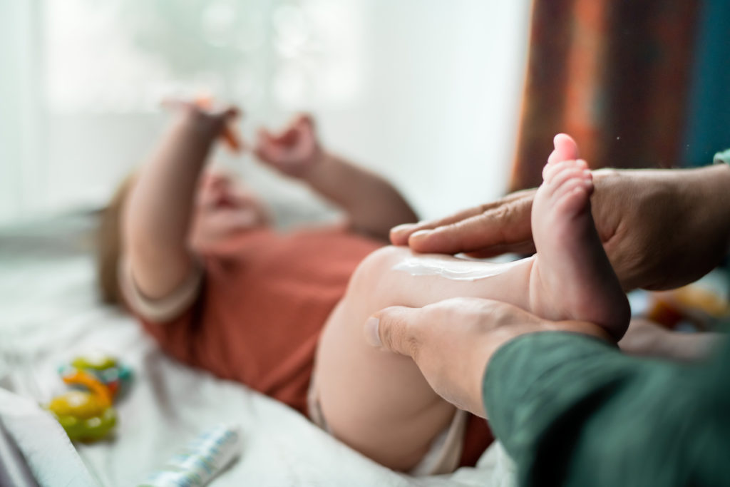 How to Help a Baby with Eczema