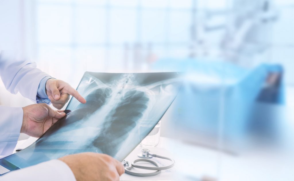 What Can a Chest X-Ray Diagnose?