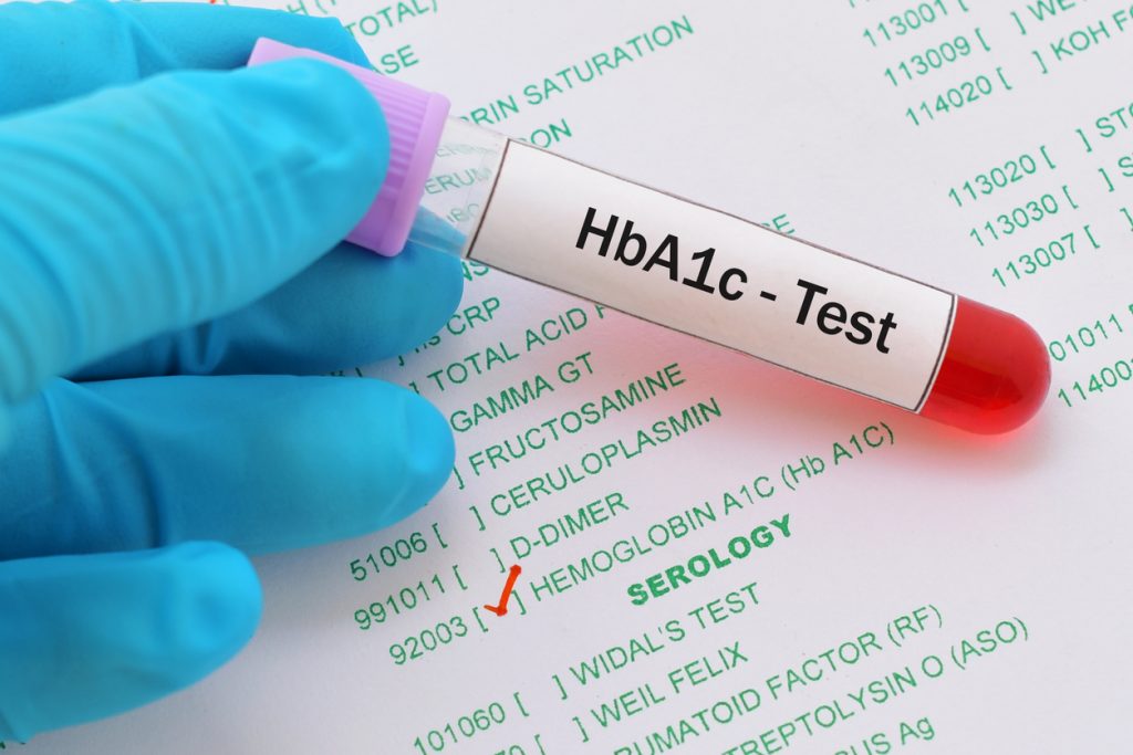HbA1C Test: Procedure, Results & Levels Explained