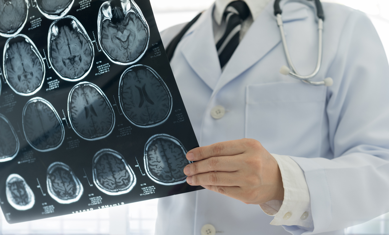 What Is A Neurologist And What Do They Do HealthEngine Blog