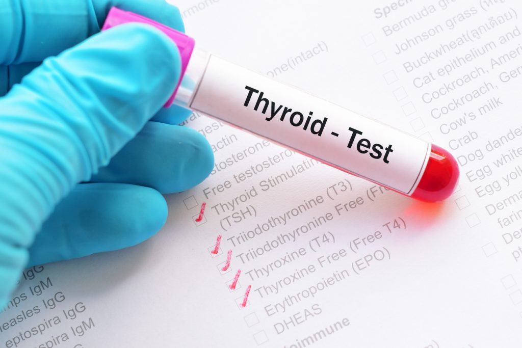 Thyroid Function Tests Explained
