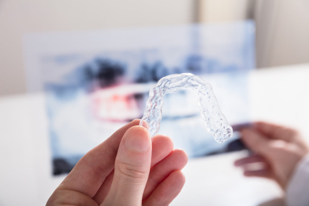 What to Expect with Invisalign