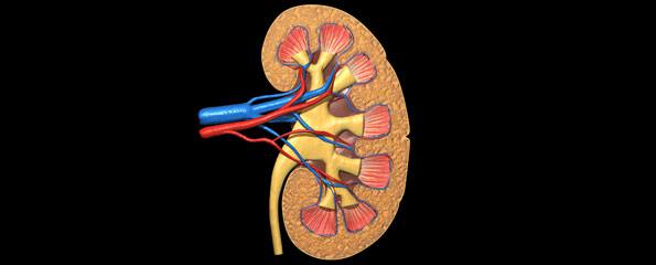 Kidney cancer: Renal manifestations of malignant disease
