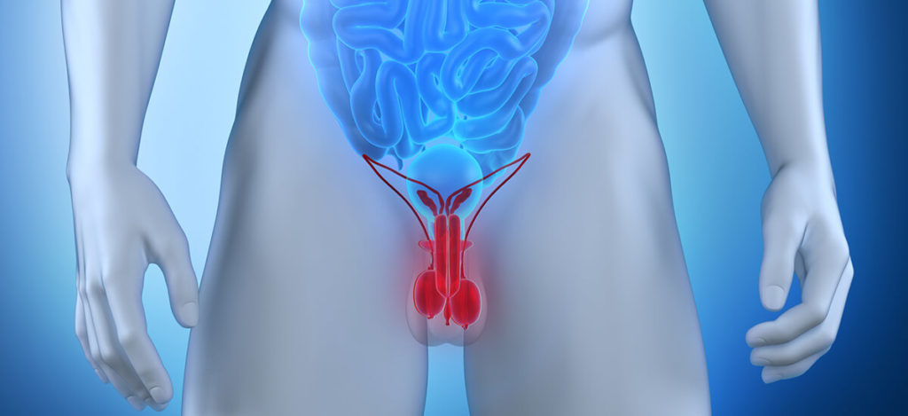 Birth defect predicts testicular cancer, infertility
