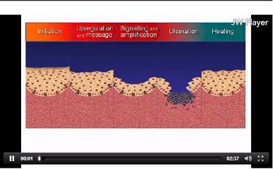 Mucositis Stages