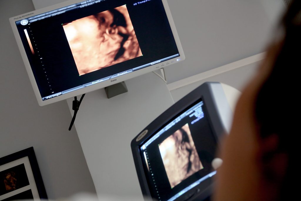 Pelvic Ultrasound Scan