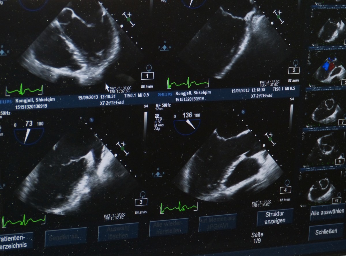 Abdominal Ultrasound Scan | Healthengine Blog