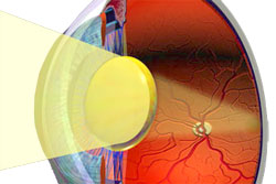 Anatomy of the eye