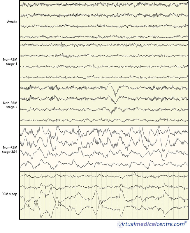 Brain wave activity during wakefulness and sleep
