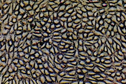 Human umbilical vein endothelial cells