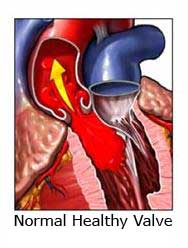 Normal healthy heart valve image