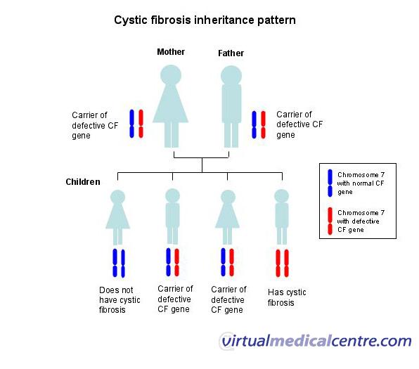 Cystic Fibrosis