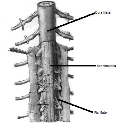 Arachnoiditis image