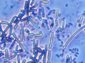 Anthrax (Bacillus anthracis) image