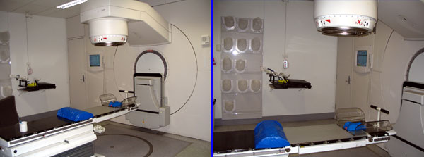 Radiotherapy