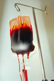 Blood donation and transfusion