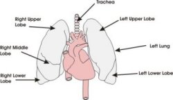 Pulmonary oedema