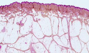 human skin layers microscope