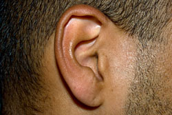 Tinnitus image