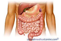 Gastrointestinal stromal tumours