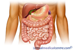 If You Have a Gastrointestinal Stromal Tumor (GIST)