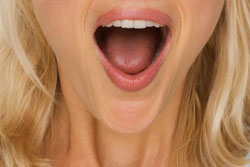 Oral thrush image