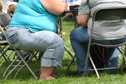 Obesity and its cost on the workforce