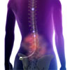 Spinal cord stimulation