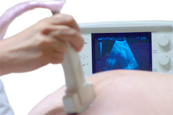 Ultrasound