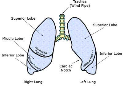 cystic fibrosis lungs diagram